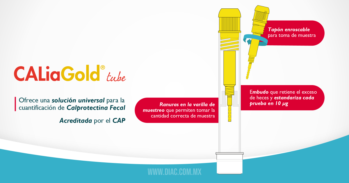 DIAC_MX's tweet photo. Conoce más sobre CaliaGold® tube en:
https://t.co/61ROb1QupC

✉ ventas@diac.com.mx

#Diagnostico #Prevencion #Calprotectina #SentinelDiagnostics #DIAC #EII #Crohn #SidrondromeIntestinoirritable #EnfermedadInflamatoriaIntestinal #EII https://t.co/p0pdZynkKi