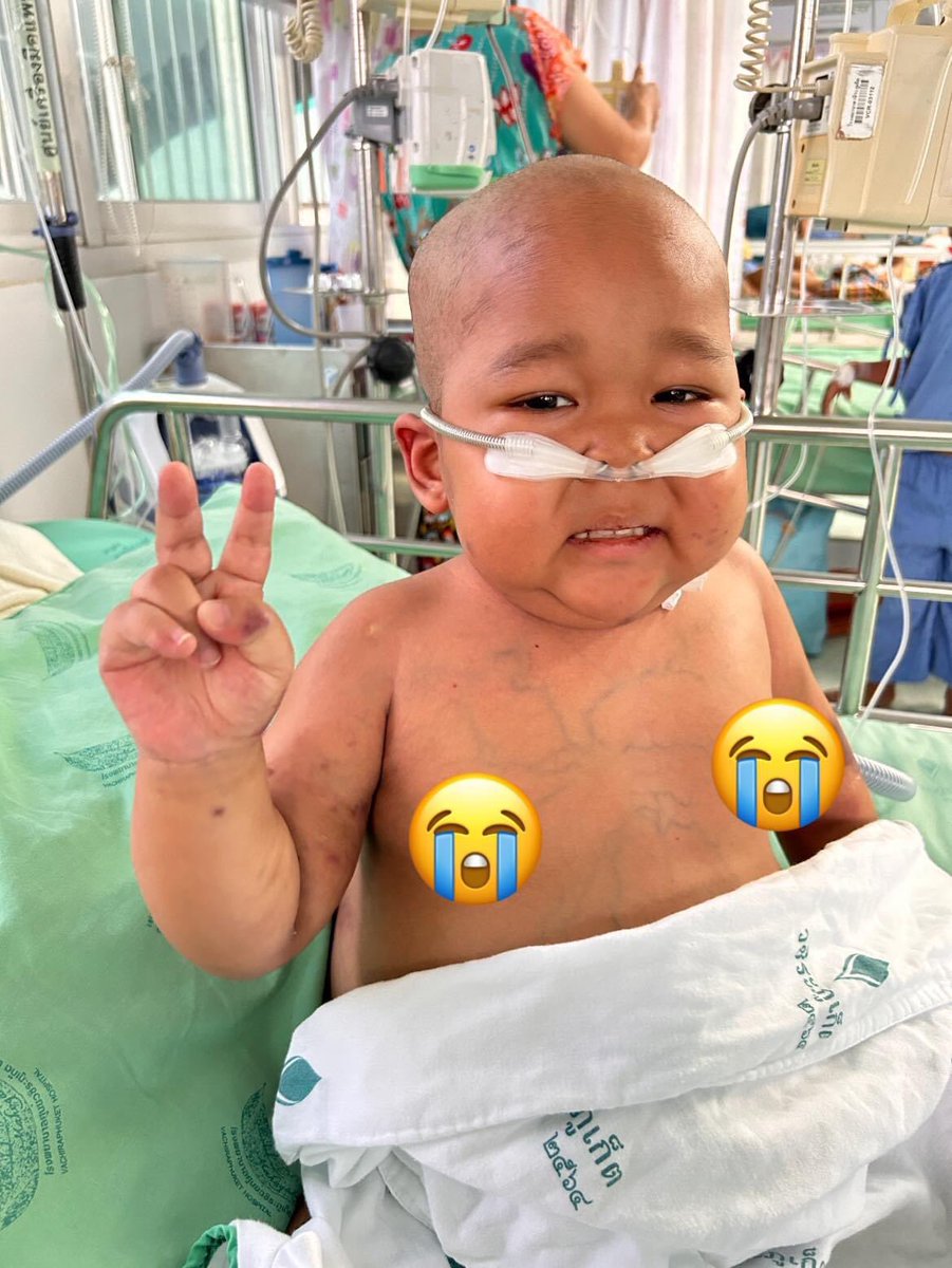 Gadebt01's tweet photo. ขอรับบริจาคเลือดกรุ๊ป AB ให้น้องปูน ตอนนี้น้องอยู่ใน PICU รพ วชิระภูเก็ต ต้องใช้เลือดกรุ๊บ AB เป็นจำนวนมาก ฝากขอช่วยทุกๆท่าน บริจาคเลือดให้น้องหน่อยนะคะ ระบุชื่อ ด.ช.พลลภัตม์ เพชรอาวุธ รบกวนด้วยนะคะ  ตอนนี้อาการของน้อง เหนื่อย เกล็ดเลือดต่ำ มีเลือดออกในกระเพาะอาหาร 🙏🏻🙏🏻🙏🏻😭 https://t.co/BSb5dcs9ep