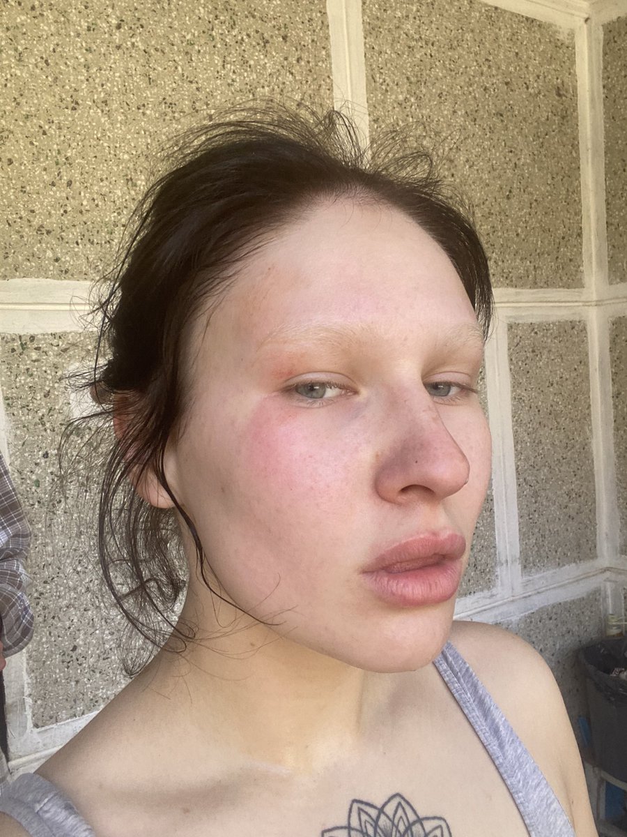 wtayanaw's tweet photo. Spending this week at art residence in Batumi 
First traumas ahaha https://t.co/BL3M3q7lEt