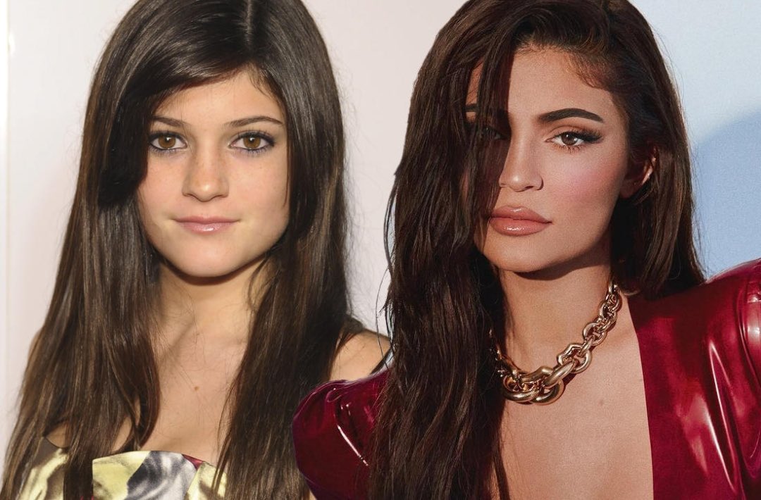 PopTingz's tweet photo. Kylie Jenner reveals she hasn’t done a lot of plastic surgery: 

“I think a big misconception about me is that I’ve had so much surgery on my face.” https://t.co/3unjybdD2B