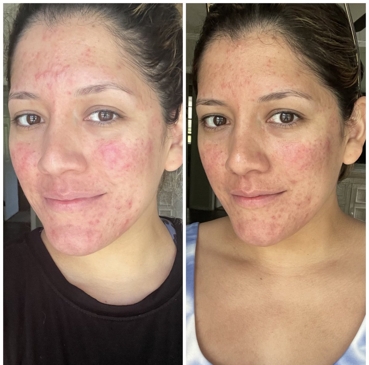 Monikishiki tweet media