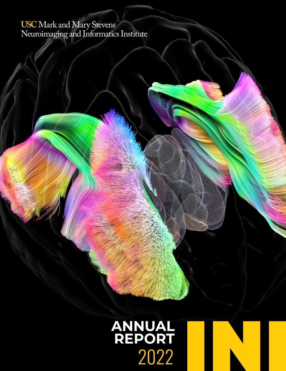 📣🎉 Our digital, interactive 2022 annual report is now LIVE! Read up on our year of innovation and discovery and check out some of our newest images, animations, and videos 🧠👀bit.ly/3A9ihCz