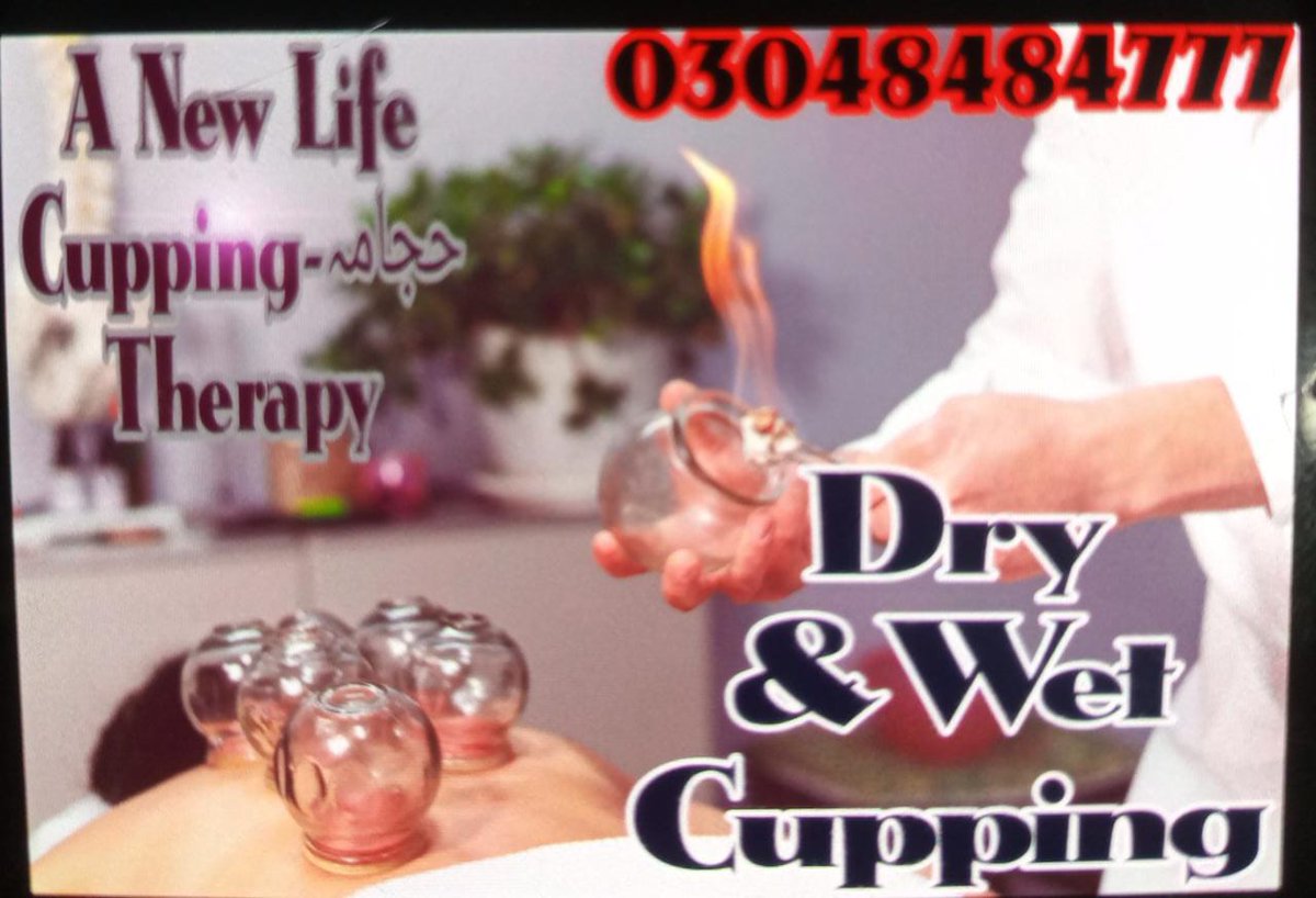 new_cupping's tweet photo. Proponents say the increased circulation reduces tension and spasms, and can promote cell repair through improved blood flow. People who use cupping also report that it can reduce pain and disability and increase range of motion. Proponents also say that cupping is helpful for https://t.co/KhM6TsFPoS