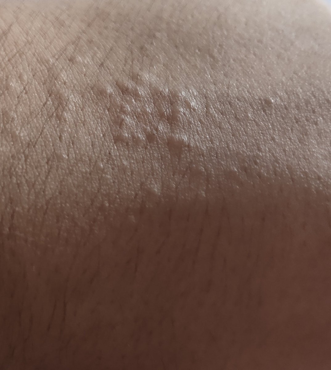 PritwaniH's tweet photo. Ever got a braile tattoo 😏? https://t.co/trt0m65K4A