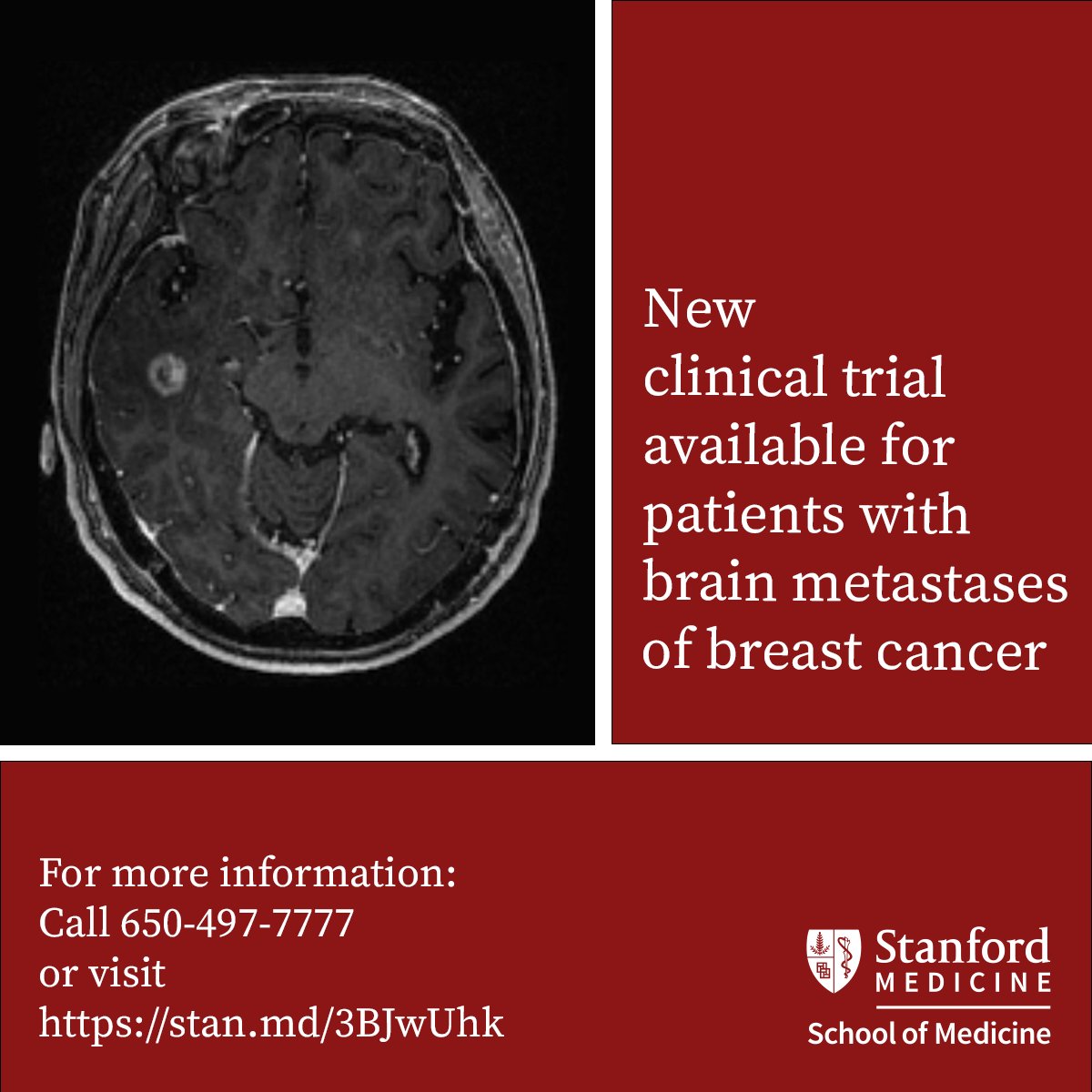 Now open at Stanford Medicine: a #clinicaltrial for patients with brain metastases of breast cancer. For more information, please visit: stan.md/3BJwUhk

For complaints, concerns, or participant's rights, contact 1-866-680-2906.
#bcsm #btsm #brainmets #mbc