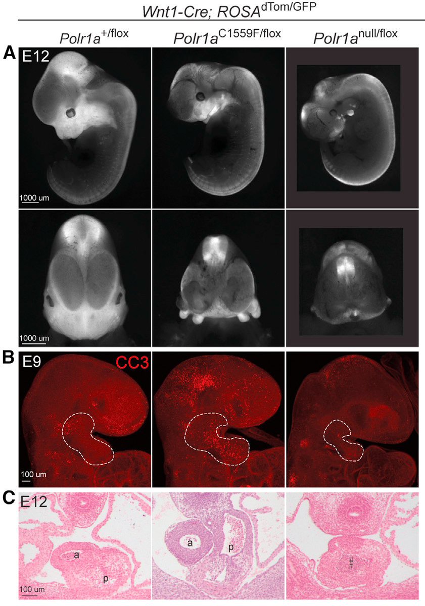 aussiebiologist's tweet photo. Connecting #ribosome biogenesis to rare disorders! Happy to share this collaborative work with @DrNicoleWeaver Kelly Sallwood @wattk11 @StottmannLab and others on #POLR1A variants and phenotypic heterogeneity in #craniofacial, neural and #cardiac anomalies.https://t.co/J9MptH0UFC https://t.co/IKtPWDAjL9