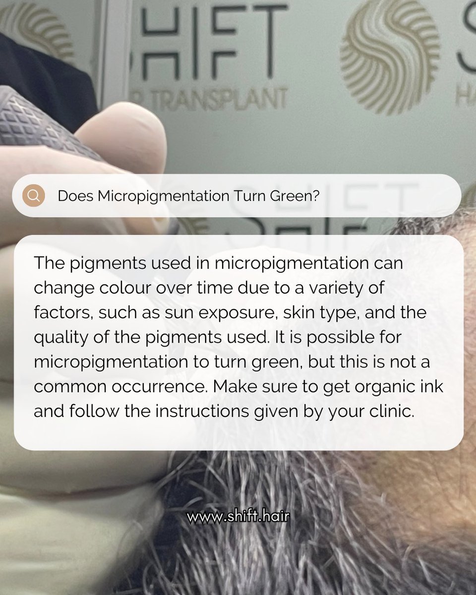 shifthairtr's tweet image. Does Micropigmentation Turn Green?

#scalpmicropigmentation #micropigmentation #smp #hairtattoo #hairshading #micropigmentationturkey #micropigmentationistanbul #micropigmentationinturkey #micropigmentationinistanbul #micropigmentationartist #micropigmentationspecialist