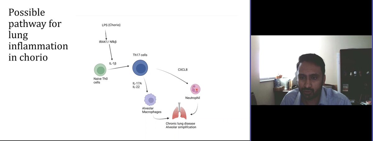 songMD's tweet photo. Dr. @vjain_md research revealed possible pathway for lung inflammation with chorio.
IL-1b & IL-17A appear to be key players.
#NeoTwitter
#LearnWithKP https://t.co/P1Z7xRfUDO