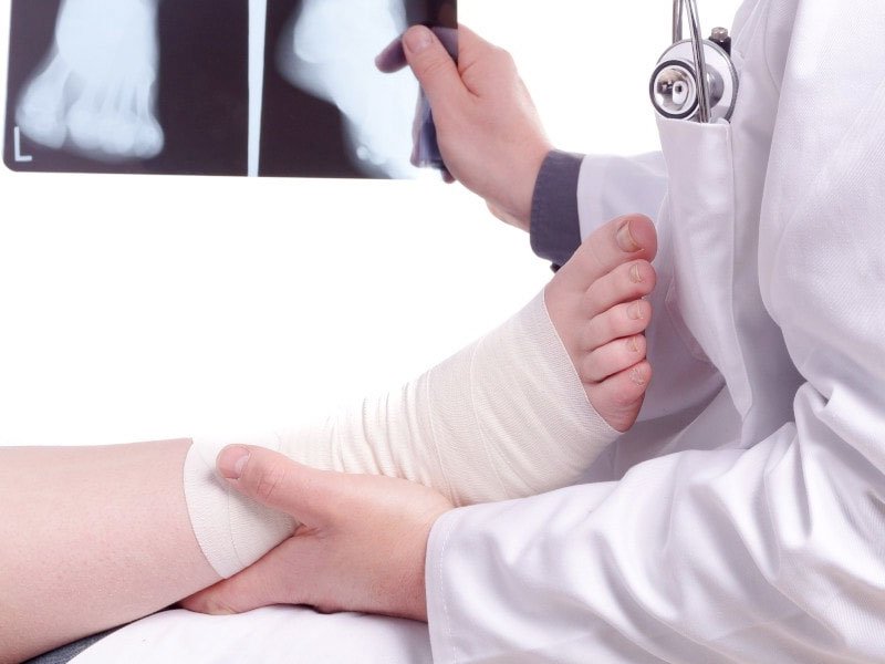 When do you need bunion surgery? Here's a quick expert guide to help you decide: bit.ly/3okQMDo

#bunions #bunionsurgery #bunionsurgeon #UFAI #footandanklesurgeon #SantaMonica #LosAngeles
