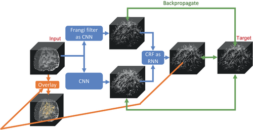 JeiranC's tweet photo. 4) - Compared to the filter-based image processing algorithm, data driven PVS segmentation method differentiates the white matter hyper-intensity from PVS resulting low false positive rate using quality-controlled data as the training target.
https://t.co/Ej6fOv5jth https://t.co/L6bMpepi2n