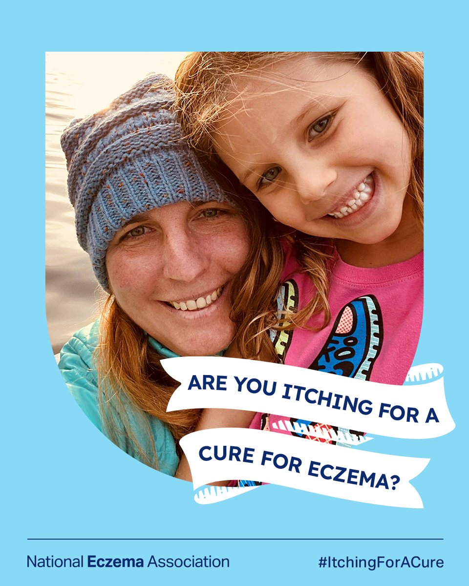 nationaleczema's tweet photo. Are you #itchingforacure? Help us raise money for #eczemaresearch! 

Eczema champion ecz-traordinaire Dr. Peter Lio is matching all funds raised up to $30,000!

Make a donation today: https://t.co/JTVyHAdv29

#eczemafundraiser #GetEczemaWise #eczema #atopicdermatitis https://t.co/FiYSFj2qrN