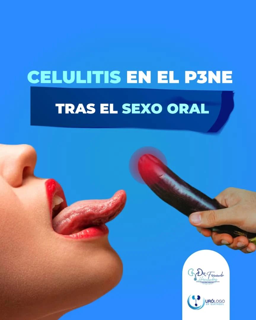 urologofernando's tweet photo. La celulitis es una infección bacteriana cutánea común y potencialmente grave en la que la piel aparece hinchada y roja y suele ser dolorosa y cálida al tacto.

debe ser revisado por un especialista para recomendar el mejor tratamiento, puedo ayudarte.👇🏻 https://t.co/wOswUO7Otg