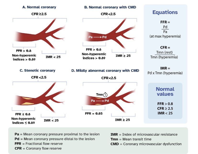 nadia_sutton's tweet photo. A comprehensive review of invasive and non-invasive best practices for physiologic evaluation of coronary stenosis by @AshwiniKerkar Jerry Juratli @aakumarMD and Thomas McLaren @UMichCardiology @umichCVC @vumccardsfit @VUMC_heart  https://t.co/dpCXog9okT%… https://t.co/AVG3cZqCk1