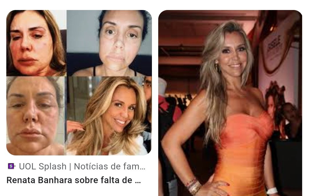 <a href="/AleRathis/">ale rathis</a> <a href="/erikasexualidad/">Erika de Paula🍍</a> É a Renata Banhara. Foi abandonada no hospital, colocada pra fora de casa, agredida, teve o plano de saúde suspenso durante o tratamento dela, além, obviamente, de ter sido traída enquanto estava internada.