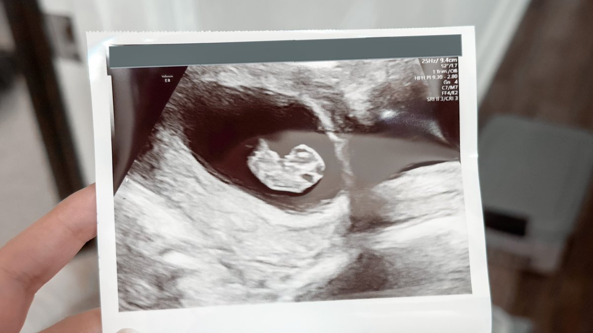 AFabledFawn's tweet photo. I’m so elated to finally share the news that there will be a Baby Girl Fawn coming in November!💖🦌 I’ve been wanting to tell you all for what feels like forever!!! Here’s a lil ultrasound pic from when I was 8 weeks along!🥰 https://t.co/EauBMkGYaU