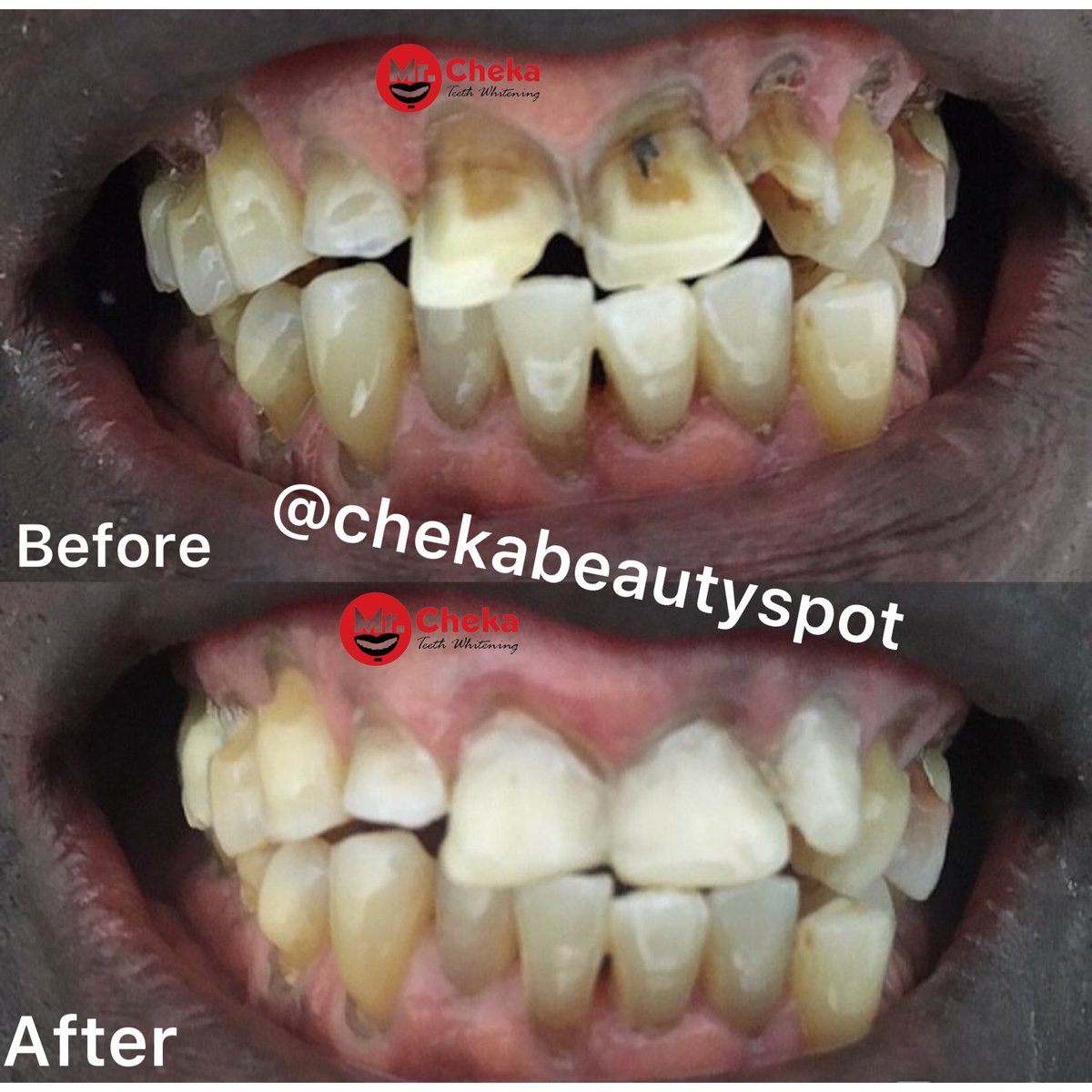 chekabeautyspot's tweet photo. Dawa ya uhakika kabisa ya mr cheka inasafisha meno na kuyafanya meupe pee PAPO KWA PAPO!!!

Agiza dawa yako sasa kwa matokeo ya uhakika!! Kwa mawasiliano:
0757698000 au 0759540354 au 0746992299 https://t.co/7OcP9f3nnd
