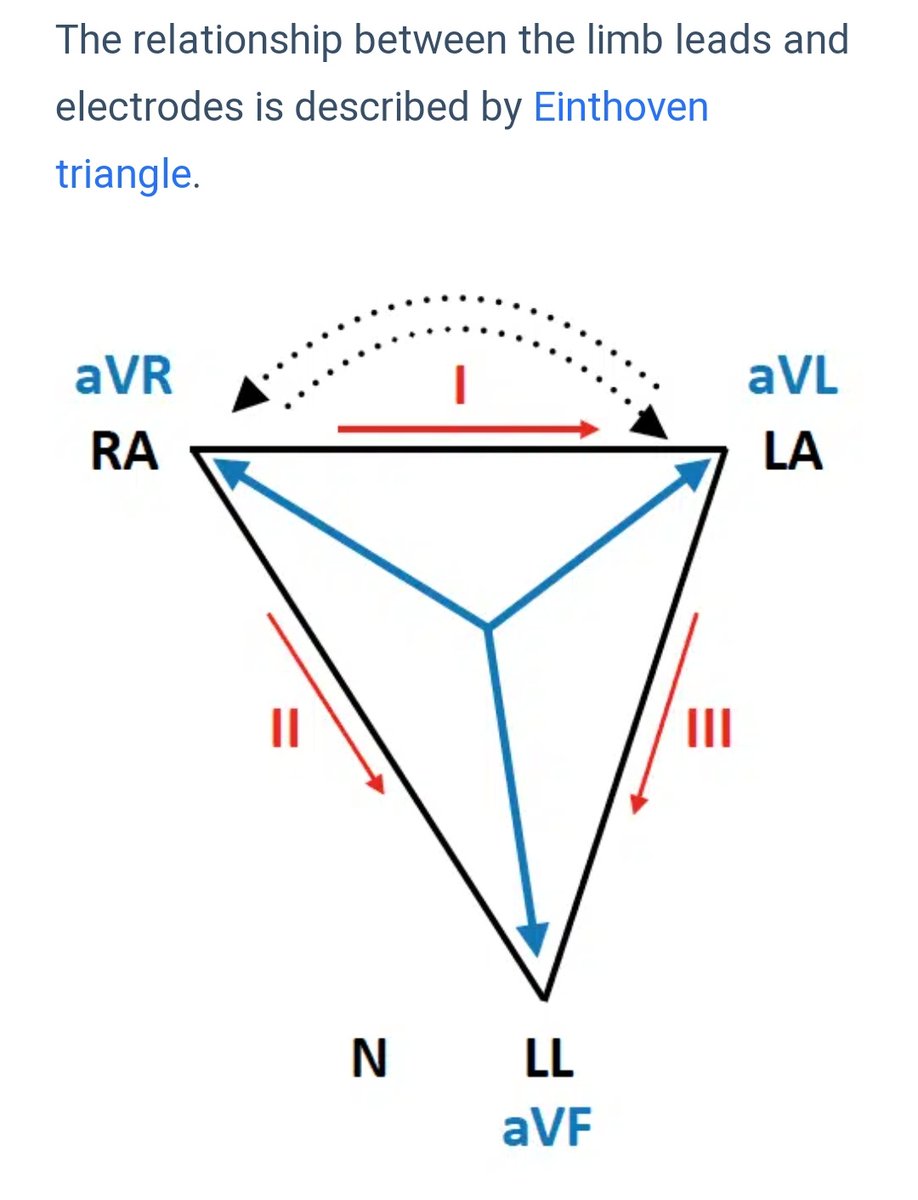 drcheruvarun's tweet photo. ECG limb lead reversals demystified 👇

With diagrams and example ECGs lifted from @LITFLblog

All u need to start is knowledge of the basic Einthoven 🔻 https://t.co/pRHSCmbrm1