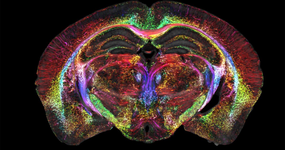 ericpshorts's tweet photo. MRI Brain Images Just Got 64M Times Sharper https://t.co/eJKsBydxFq curated by eric https://t.co/UQyhYgvqps