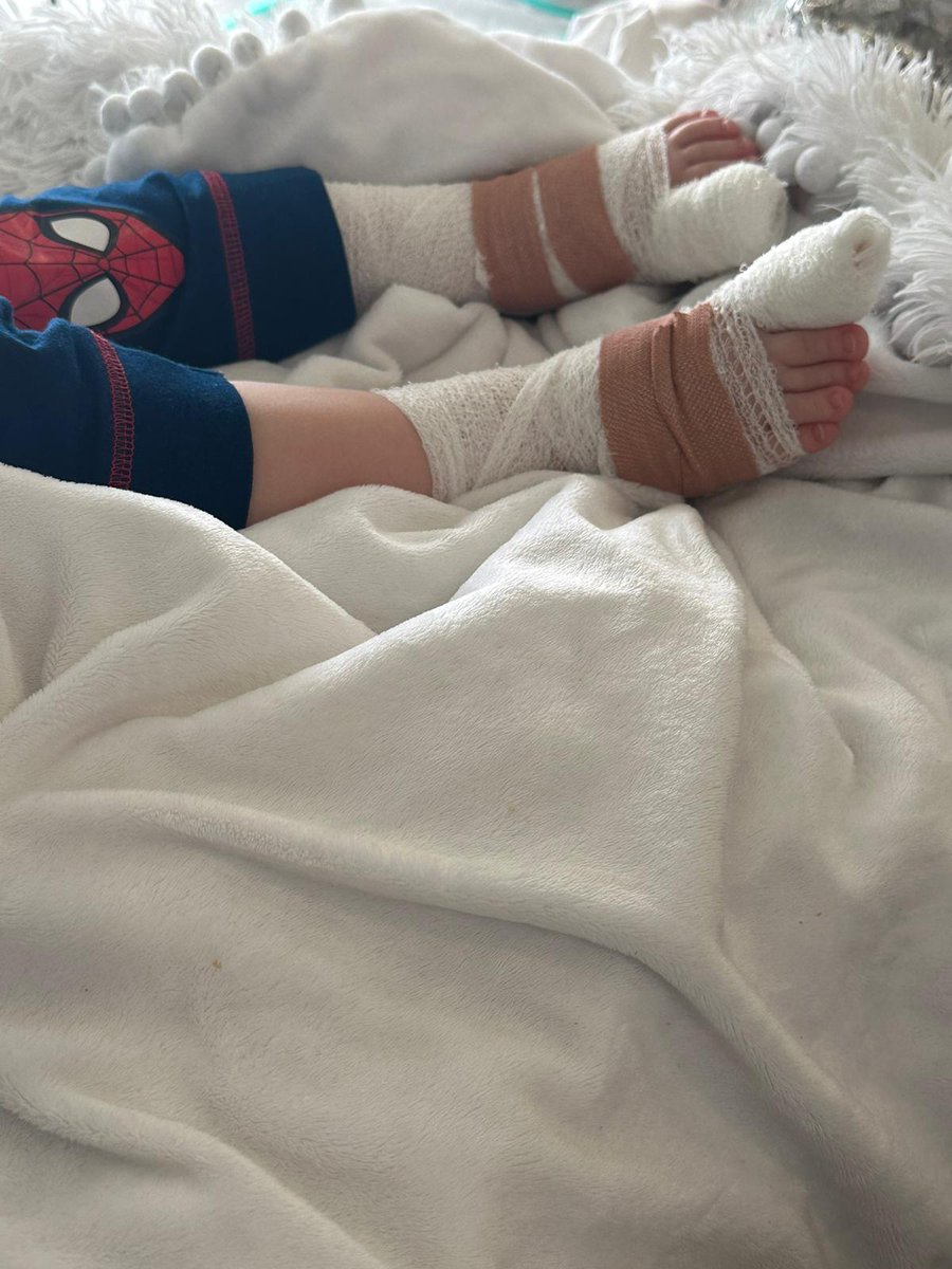 Cairnlodge1's tweet photo. My wee #grandson #Blye had an #operation on his 2 great #toes this morning. I #love my #grandkids so so much. 💙🙏 https://t.co/bqpJdGooXu