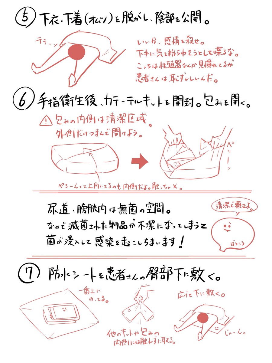膀胱留置カテーテル挿入の手順。(1/2) 