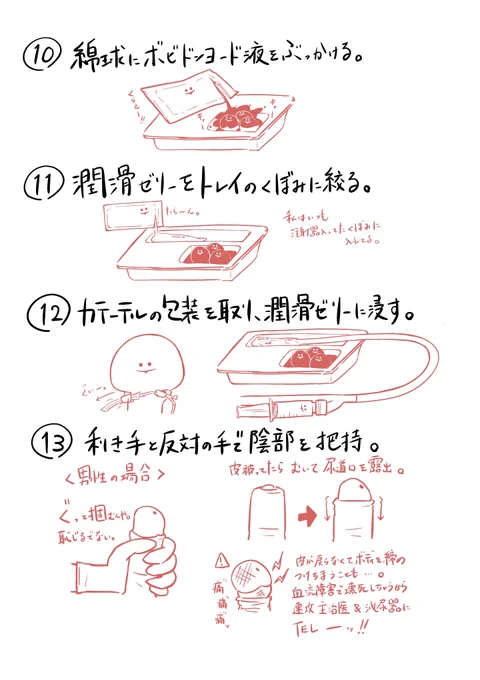 膀胱留置カテーテル挿入の手順(2/2) 