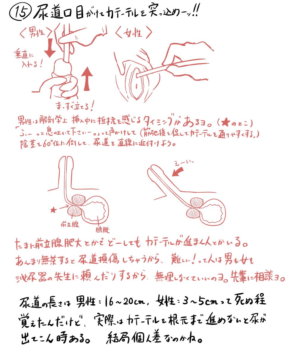 膀胱留置カテーテル挿入の手順(2/2) 