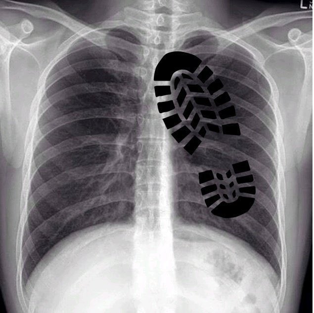 Sabonis X-Ray results look brutal 😔