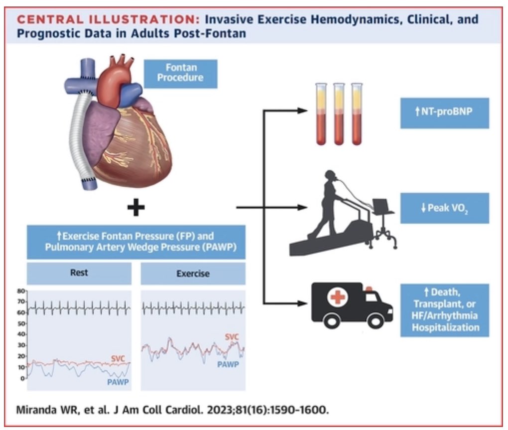 New important data for Fontan patients :
🔹Exercise Fontan pressure and PAWP correlate with NT-proBNP and peak VO2.
🔹Exercise Fontan pressure and PAWP are associated with mortality, transplant or hospitalisation. #invasiveFontanpressure
 @jaccjournals jacc.org/doi/abs/10.101…