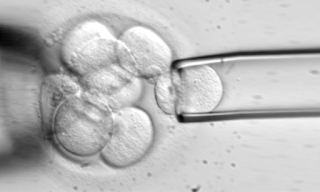 Diagnóstico genético preimplantacional - DGP blgs.co/0D32HI