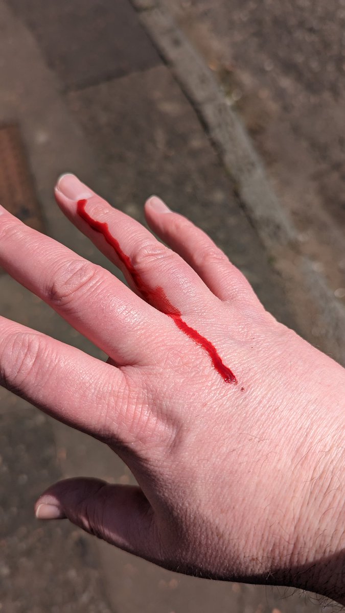 cowrin's tweet photo. Every six months or so, I fall prey to the mysterious malady known as 'Letterbox Knuckle'. Scientists are at a loss as to why this affliction only affects political party volunteers and not Royal Mail workers https://t.co/W8ARHfDj0j