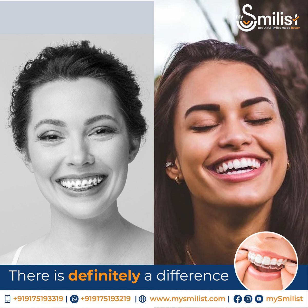 MySmilist's tweet photo. Get the perfect smile you've always wanted with mySmilist clear aligners! Say goodbye to traditional braces and hello to a more comfortable, convenient, and discreet teeth-straightening option. Invest in your dental health and boost your confidence with a smile you'll love! 😁 https://t.co/HJhzwmwVkh