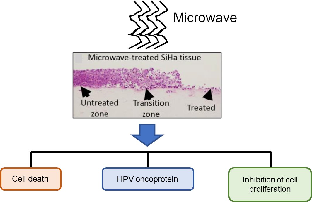 📰 NEW PAPER | Microwave treatment can be a novel targeted therapy for human papillomavirus (#HPV)-associated cancer progression.

New publication from The Graham Group published in <a href="/eBioMedicine/">eBioMedicine – The Lancet Discovery Science</a>.

Read: thelancet.com/journals/ebiom…

Read <a href="/IlariaEpifano/">Ilaria Epifano</a>'s thread for more info 👇