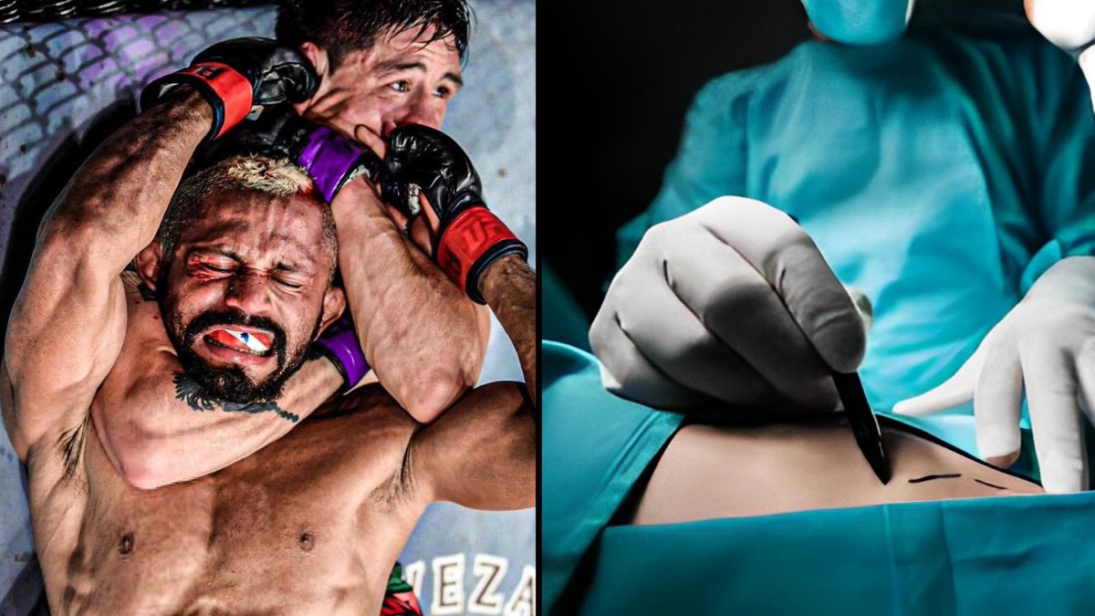 Surgical lessons from Brazilian Jiu Jitsu.

How fighting helped me complete neurosurgical training 👊🏽