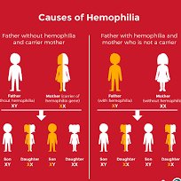 SAfmRadio's tweet photo. [ICYMI] In our #HealthFeature, we commemorated #WorldHaemophiliaDay and unpacked how blood disorders impact our everyday lives. We are joined by Dr. Nicholas Mangeya of @Roche_Africa  &amp; Dr. Ngoakoana Mahlachana  of @WitsUniversity on #SAfmTalkingPoint with @KGMoeketsi https://t.co/LzGnnAe76r