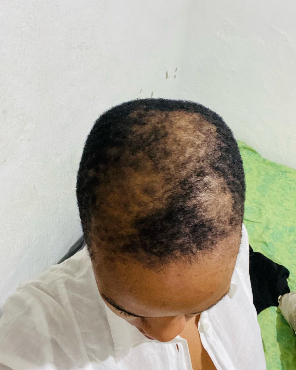 ethnogenics's tweet photo. #ProductReview 
“My hair journey hasn’t been an easy one. I have no real explanation as to what happened to my hair, I never saw a doctor, I was embarrassed and my confidence insanely low. 
Super grateful to @GailMabalane for creating and introducing @ethnogenics to the world.” https://t.co/p0lKodqaZ4