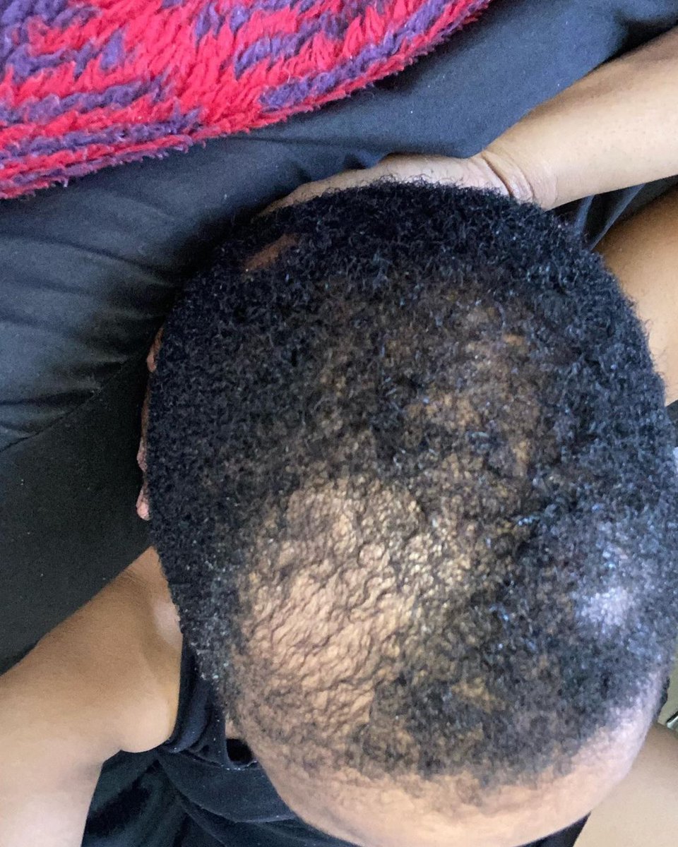 ethnogenics's tweet photo. #ProductReview 
“My hair journey hasn’t been an easy one. I have no real explanation as to what happened to my hair, I never saw a doctor, I was embarrassed and my confidence insanely low. 
Super grateful to @GailMabalane for creating and introducing @ethnogenics to the world.” https://t.co/p0lKodqaZ4