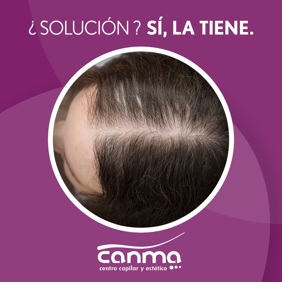 A los problemas, soluciones, en Canma nuestros innovadores Tratamientos Capilares de última generación solucionarán tu problema capilar, contacta con nuestro equipo de expertos en el cabello y solicita consulta GRATUITA: Tel. 976 48 40 80 #SolucionesCapilares #28añosdeExperiencia