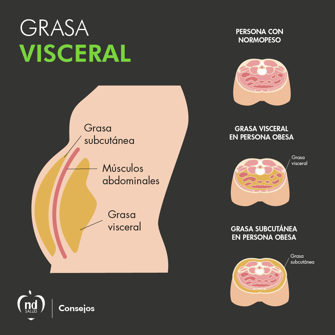 pabloa_ndsalud's tweet photo. 📣 ¿Sabes que es la grasa visceral?
La grasa visceral se acumula en la cavidad abdominal y alrededor de los órganos internos como el hígado, el páncreas y los intestinos. 

💻: https://t.co/47mFXKuVu1
.
#NDSalud #PabloALopez #clinica #consulta #clinicadenutricion #nutricion https://t.co/nvya9en99W