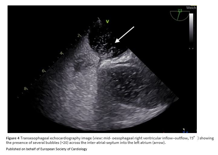 European Society of Cardiology Journals tweet media
