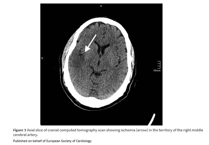 European Society of Cardiology Journals tweet media