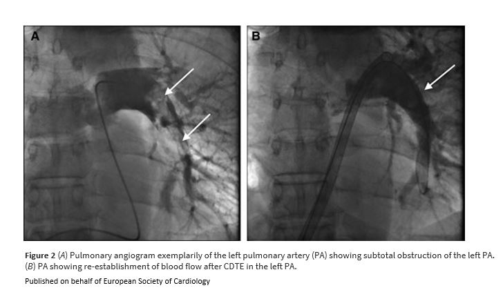 European Society of Cardiology Journals tweet media