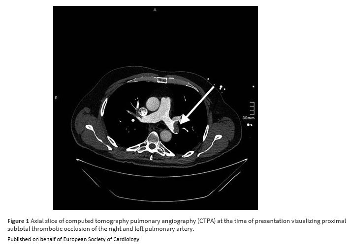 European Society of Cardiology Journals tweet media