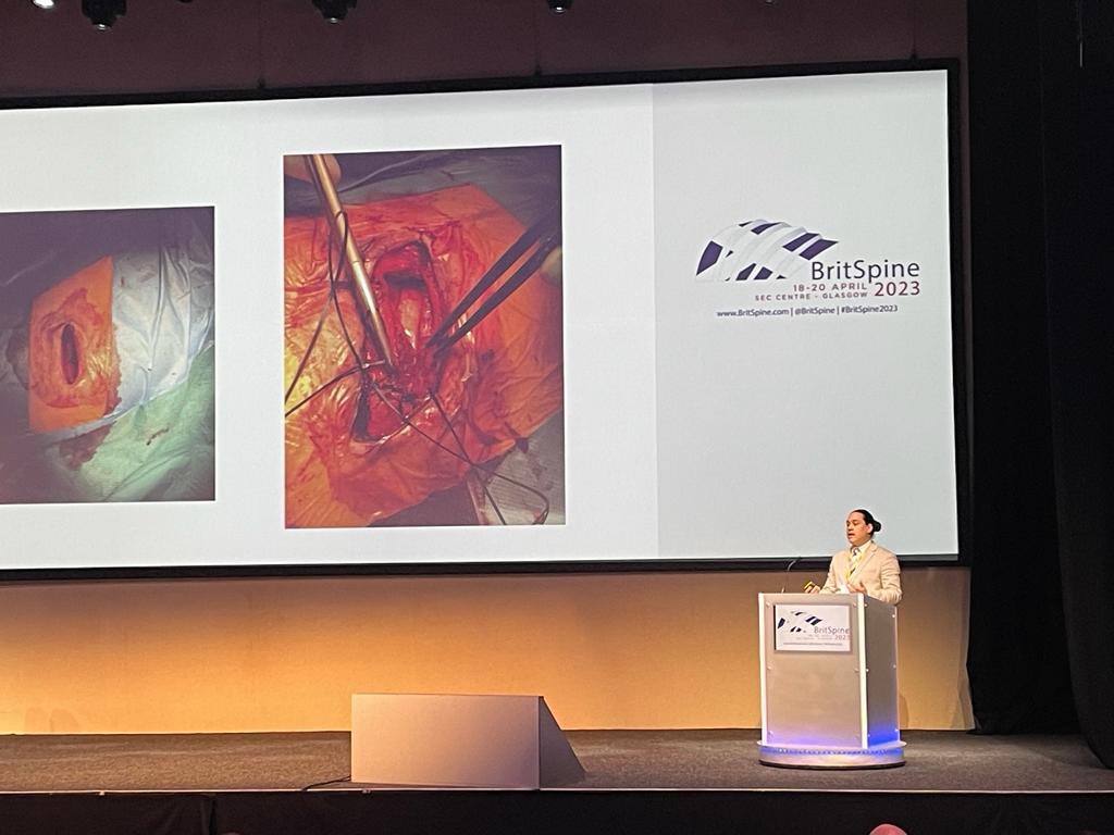 PLoughenbury's tweet photo. 3 out of 6 presentations in the degenerative spine session @BritSpine this morning from Leeds. Well done everyone! #BritSpine2023 https://t.co/chzY54uAwc