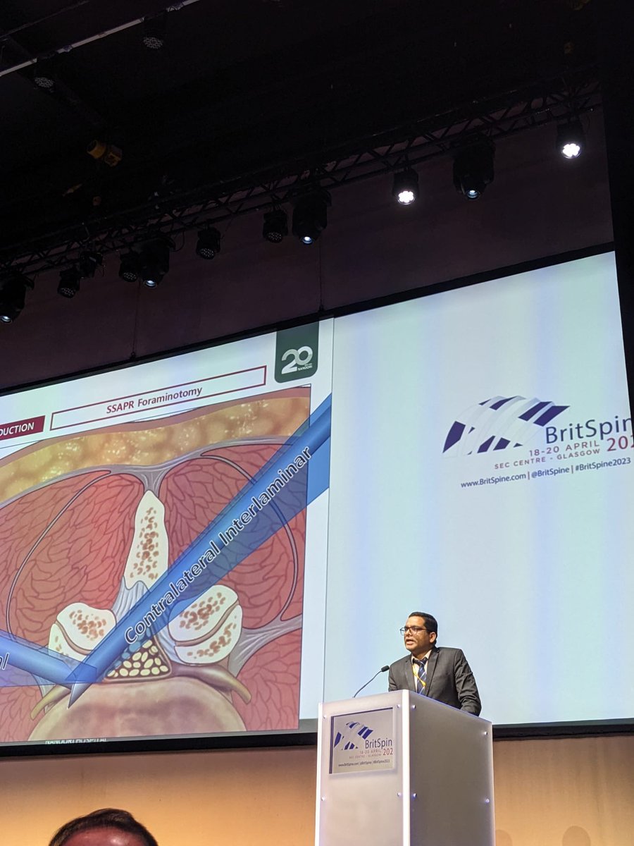 Peter Loughenbury (@ploughenbury) on Twitter photo Interesting talk from one of our Leeds Fellows reporting results of endoscopic surgery during his fellowship in South Korea. Excellent work Nitin Adsul! <a href="/BritSpine/">BritSpine Conference and Exhibition</a> #BritSpine2023 Interesting talk from one of our Leeds Fellows reporting results of endoscopic surgery during his fellowship in South Korea. Excellent work Nitin Adsul! <a href="/BritSpine/">BritSpine Conference and Exhibition</a> #BritSpine2023