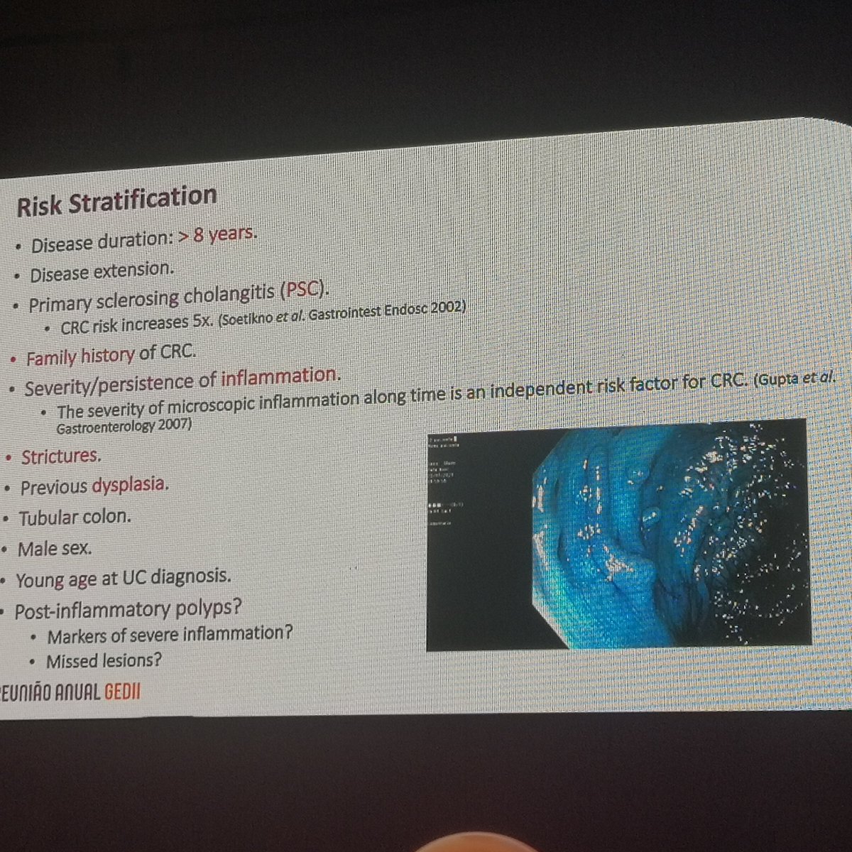 GEDII_IBD's tweet image. 🚨 #Advancedcourse on #IBD endoscopy endorsed by @Y_ECCO_IBD
🏁 Risk stratification
Some risks are universal, some are controversial
💬 Random biopsies VS Target
* Very low physician adherence
* Benefit if previous displasia, deficient prep, inflammation, CEP, or tubular colon