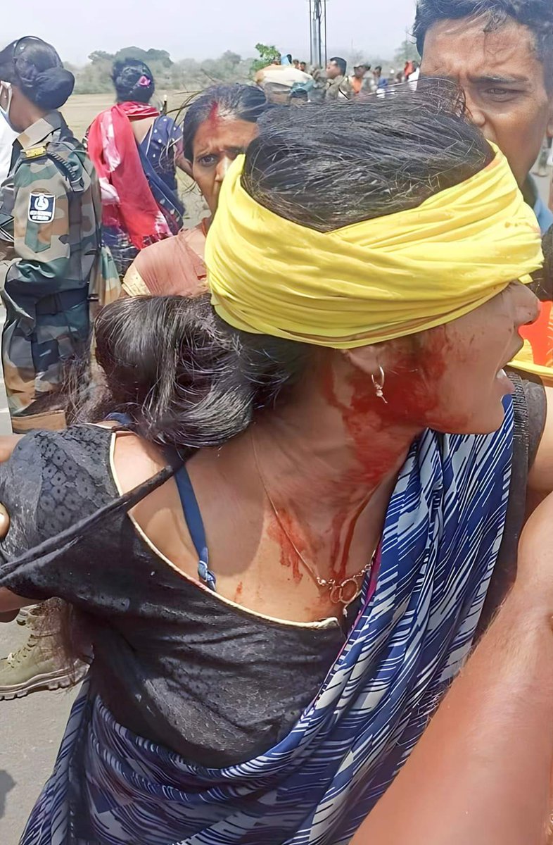 कुछ लोग अभी भी घर में बैठे हैं, कोने में दुबके पड़े हैं।।एसी कमरे में एलईडी स्क्रीन पर लुत्फ उठा रहे हैं...
याद रखिए जब आप अपने जीवन के मौज के मजे ले रहे हैं, ठीक उसी वक्त कोई सड़क पर अपना काया लहू से लथपथ करते हुए, आपके बच्चों के भविष्य की सुरक्षा हेतु, आपके हिस्से की लड़ाई,