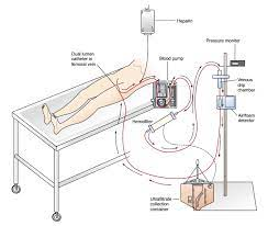 Nephrol00976063's tweet photo. Renal Replacement Therapy is a crucial lifesaving treatment for those with kidney failure. Recent advancements in technology and research bring hope for improved outcomes. #kidneyhealth #medicaladvancements #healthcare 
view journal page: https://t.co/RCBIC1A6wh https://t.co/ONdYLcDcej