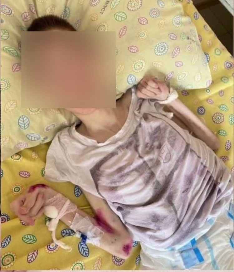 Прокуратура проверит психоневрологический интернат №10 в Петербурге после смерти семи сирот. Они были жутко истощенными и измученными.

Устроили концлагерь, ублюдки