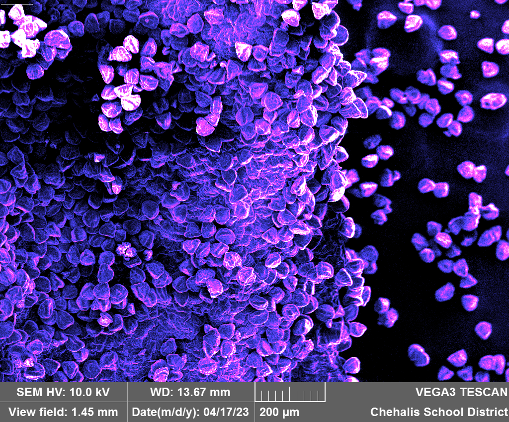 wfw_sem's tweet photo. Tulip Pollen-Brea Tracy
#allergyseason https://t.co/oSEnkQvylt