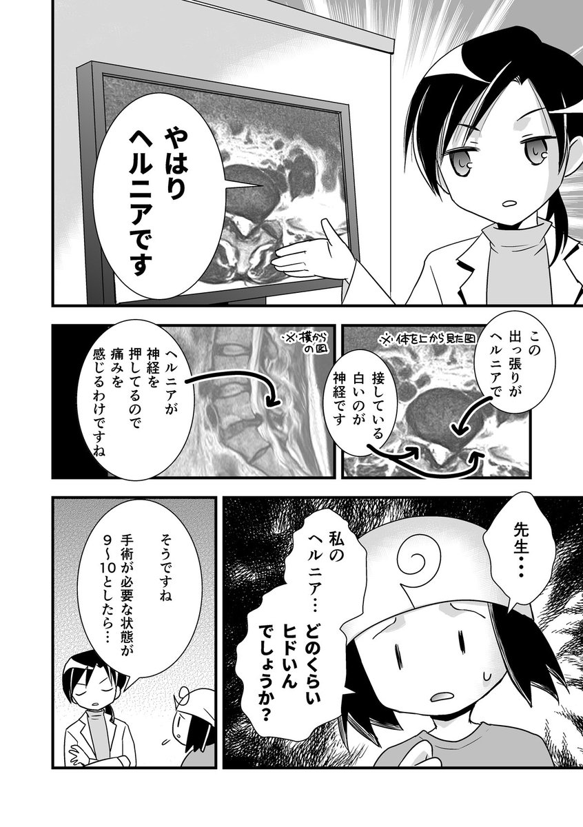 コミケがきっかけで腰が死んだ話。第6話-1/2 
（腰痛トラブル漫画）

MRIという、X線を使わないレントゲンみたいなものをやった話。

 #漫画が読めるハッシュタグ #エッセイ漫画 https://t.co/YMa89ZTTDO